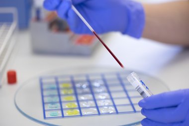 Im Labor wird das bei einer Blutspende abgenommene Blut untersucht. Ein Teil des Blutes wird in einer Pipette gezeigt.